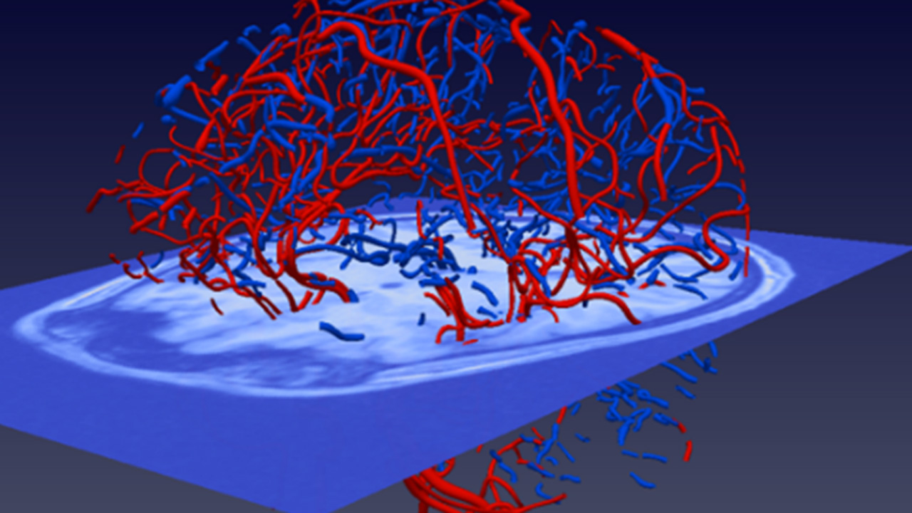 Biomedical image and signal analysis