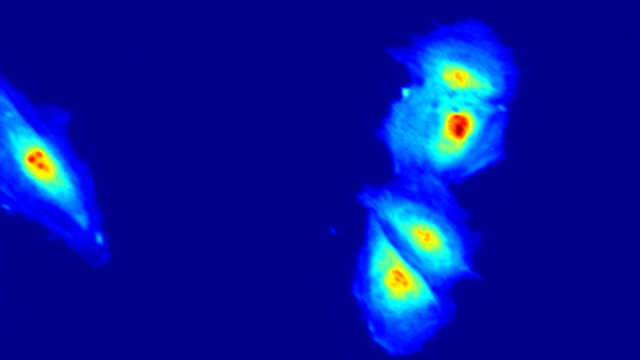 Image texture analysis